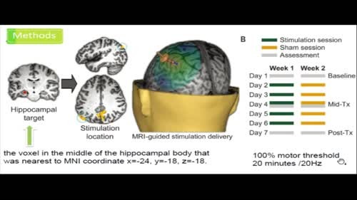 The R-fMRI Lab! 2017-03-24 10点场